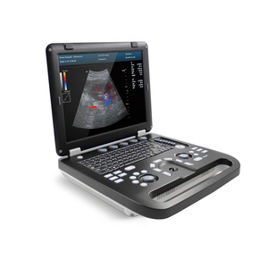 Ecógrafo veterinario a color Kangtai transfronterizo, ecógrafo B, instrumento de ultrasonido a color para animales, para monitorización cardíaca fetal - Product Image 1