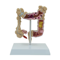 Modelo Anatómico de Intestino Grueso de PVC TIANLIAN YL-53, Maniquí Médico para Uso Escolar, Demostración de Aparato Intestinal Común