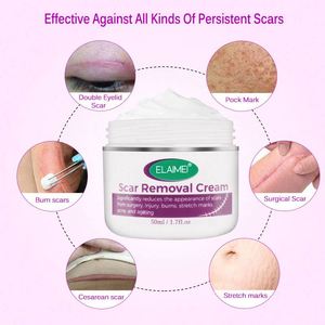Crème ELAIMEI <span class=keywords><strong>pour</strong></span> le soin de la peau, la plus efficace <span class=keywords><strong>pour</strong></span> éliminer les cicatrices anciennes - Product Image 4