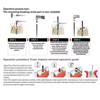 Kit de suppression totale dentaire manuelle avec jeu d'extenseur osseux Fixation cassée Implant Clé à cliquet pour une expansion osseuse efficace