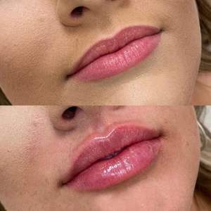 Reparación de Pieza de Mano de Láser de Hielo, Láser de Diodo de 808 nm, Reparación de Pieza de Mano de Láser, Precio - Product Image 5