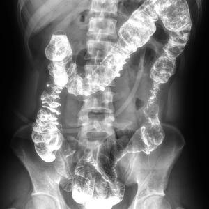 Detector de Panel Plano de Radiografía <span class=keywords><strong>Digital</strong></span> Inalámbrico de 17x17 Pulgadas con Mango, Máquina de Rayos X Portátil para Clínica y Hospital - Product Image 4