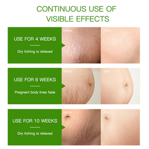 Jasminum organik minyak esensial untuk mengencangkan tubuh, mencerahkan pelembab kulit terapi perbaikan <span class=keywords><strong>Stretch</strong></span> <span class=keywords><strong>Mark</strong></span> penghilang bekas luka - Product Image 5