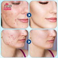 Patch anti-acné hydrocolloïde personnalisé en forme de cœur, patch transparent miracle pour couvrir les boutons et les imperfections