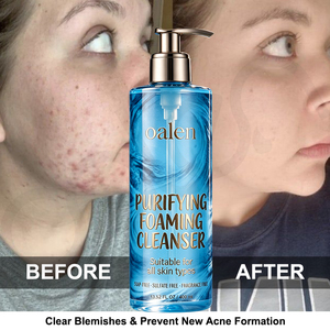 <span class=keywords><strong>Nettoyant</strong></span> moussant doux Luxfume Private Label 400 ml, contrôle en profondeur du sébum, lavage du <span class=keywords><strong>visage</strong></span> sans sulfate, sans irritation, pour peaux sensibles - Product Image 6