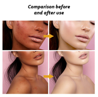 Crème blanchissante à moitié naturelle avec logo OEM pour l'élimination des taches brunes anti-âge crème de beauté hydratante en profondeur pour le visage