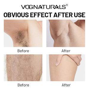 <span class=keywords><strong>Crema</strong></span> <span class=keywords><strong>depilatoria</strong></span> de etiqueta privada para <span class=keywords><strong>mujer</strong></span> Bikini Line Área íntima <span class=keywords><strong>Depilatoria</strong></span> para cara Piernas y axilas - Product Image 5