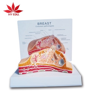 Del seno patologico modello di anatomia Modello di Pratica di Cura del seno modello anatomico - Product Image 2