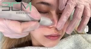 Producto para el Cuidado de la Piel HydraDEP Aqua Peel, Elimina Puntos Negros y Rejuvenece la Piel, Otros Productos de Belleza y Cuidado Personal - Product Image 6