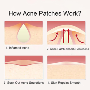 Parche Hidrocoloide Transparente Invisible Dotdot, Transpirable, Absorbe el Pus Rápidamente, Reduce las Cicatrices del Acné - Product Image 3