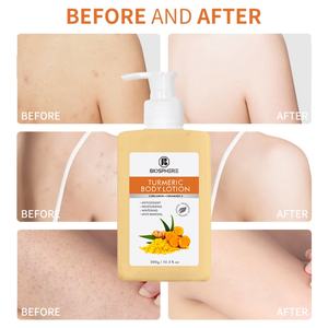 Loción Corporal Blanqueadora con Cúrcuma Sin Parabenos, Antioxidante, Aclarante, para Piel Sensible, Protector Solar - Product Image 4