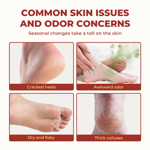 Etiqueta privada <span class=keywords><strong>Urea</strong></span> Cream Foot Care Stick Absorción rápida Hidratante profundo Exfoliante suave 60% <span class=keywords><strong>Urea</strong></span> Cream Foot Desodorante Stick - Product Image 3