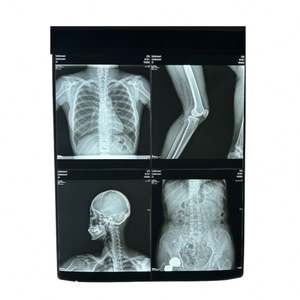 ओपन सिस्टम डिजिटल एक्स-रे थर्मल प्रिंटर चिकित्सा शुष्क थर्मल एक्स-रे फिल्म प्रिंटर - Product Image 4