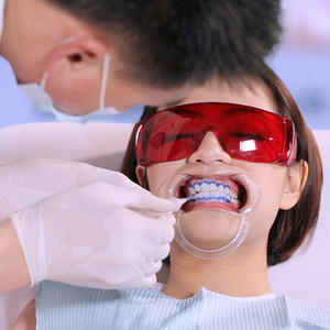 MK02 38%HP Peroxyde à haute concentration Pro Whitening, accessoires de blanchiment dentaire, kit de blanchiment des dents, vente en gros auprès d'un fabricant chinois - Product Image 6