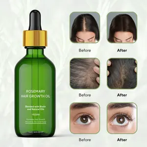 Wholesale private label alecrim óleo de crescimento do cabelo natural orgânico puro óleo de hortelã alecrim para o óleo natural do crescimento do cabelo