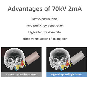 Appareil de radiographie numérique portable de Chine - Utilisation <span class=keywords><strong>dentaire</strong></span> et vétérinaire avec imagerie <span class=keywords><strong>panoramique</strong></span> et céphalométrique pour clinique et laboratoire - Product Image 5