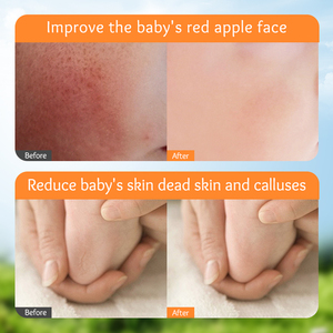 OEM SADOER Private Label bambini <span class=keywords><strong>Calendula</strong></span> vitamina E nutriente idratante idratante vegano Anti-Cracking cura della pelle <span class=keywords><strong>crema</strong></span> per il viso - Product Image 6