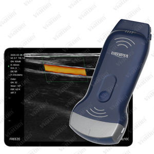 Avaliação da Rotina Ultrassonografia Obstétrica no Meio da Gravidez Ultrassonografia Obstétrica - Product Image 5