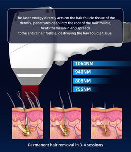 Laser Diode Boslaser 1000W pour Traitement Esthétique du Visage et du Corps Entier, Épilation, Rajeunissement de la Peau, Refroidissement par Glace, Technologie IoT - Product Image 4