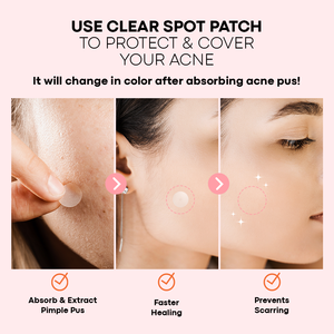 Patch de tache claire Patch d'acné Invisible hydrocolloïde guérison rapide étanche pour les peaux sensibles végétalien maquillage coréen amical - Product Image 4