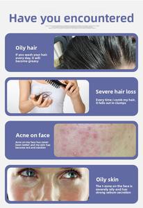 Topi <span class=keywords><strong>Stimulator</strong></span> Pertumbuhan Rambut Portabel Mempromosikan Regenerasi Kulit Kepala Produk Perawatan Kesehatan Rumah - Product Image 4