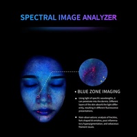 Analizador de Piel Profesional, Sistema de Diagnóstico de Piel 3D para Aplicaciones Comerciales en Spas