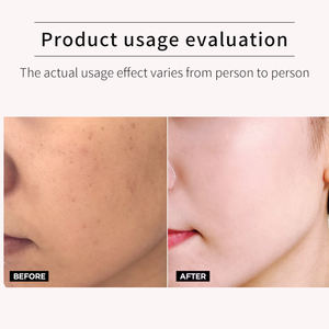 活性化ブライトニングクリーム放射性複合体のためのデュアルアクションスポットリダクション & 肌栄養 - Product Image 5