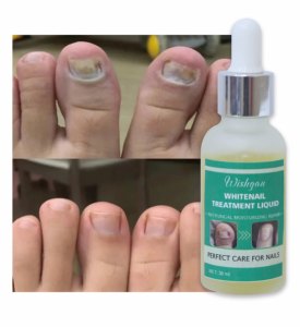 Líquido para <span class=keywords><strong>Eliminar</strong></span> Hongos en las Manos con Ingredientes Minerales, Exfoliante e Hidratante para Aclarar, Personalizable - Product Image 2