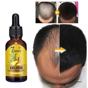 מרכך שיער EELHOE ג'ינג'ר מעניק לחות לקרקפת ומייצב שיער למניעת נשירת שיער