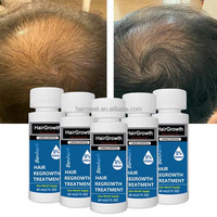 Kit d'huile capillaire bio 5% à base de plantes pour la repousse des cheveux, avec sérum nourrissant à l'huile de ricin pour le traitement de la perte de cheveux