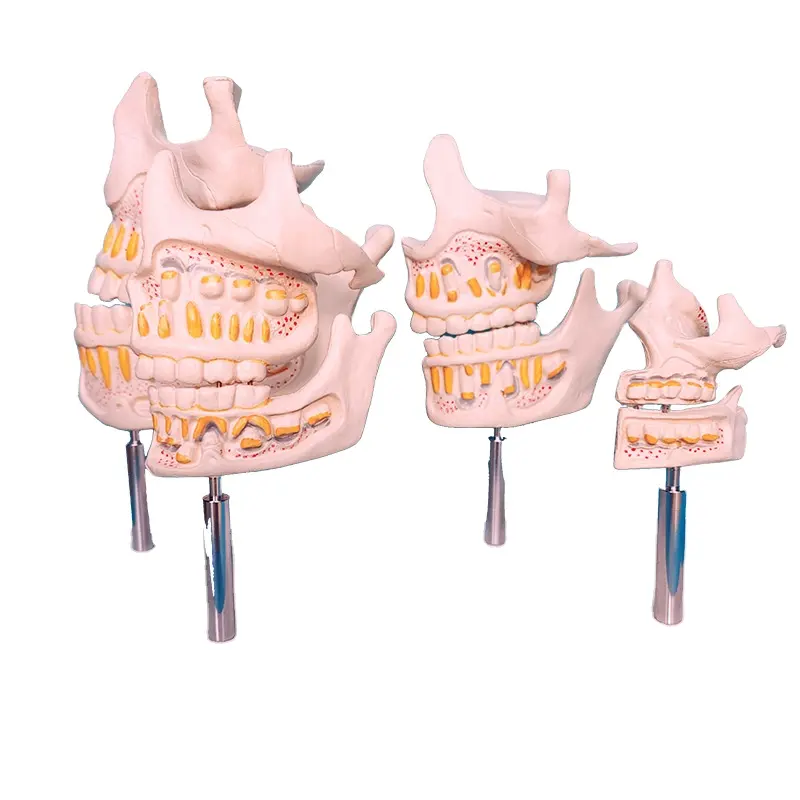 Modelo Anatomia Mandíbula Humana Anatomia Biomimética Humana Dentes e Modelo Ensino Demonstração Crescimento Dentário