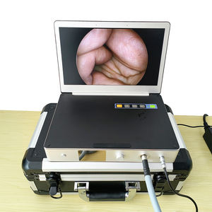 Draagbare Alles In Één Hd Fhd 1080P Chirurgische Medische Endoscoop Camera Voor Ent/Laparoscopie/Hysteroscopie/Urologie Chirurgie - Product Image 4