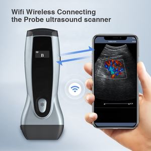 ヨンカーWiFiミニダブルプローブハンドヘルド牛ペット製品動物＆ポータブル獣医超音波スキャナーモニターマシン - Product Image 4