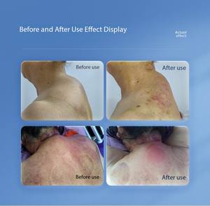 JYTOP grosir alat fisioterapi bekam pijat DDS multi-fungsi tubuh Bio Meridian instrumen pengeruk elektroterapi - Product Image 2