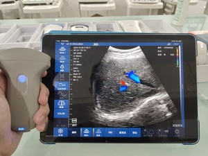 DMU86 カラー ドップラー ワイヤレス プローブ ハンドヘルド ワイヤレス 超音波スキャナー リニアプローブ 最安値 - Product Image 2