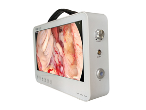 Cámara de Endoscopia Portátil Manual de Grado Médico con FHD/1080P para Laparoscopia, ORL, Histeroscopia y Procedimientos Urológicos - Product Image 2