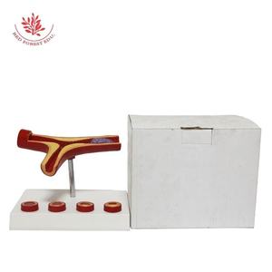 Modèle d'anatomie en PVC <span class=keywords><strong>vasculaire</strong></span> Matériau de haute qualité fait à la main Athériosclérose et thrombose Modèle de <span class=keywords><strong>pathologie</strong></span> des vaisseaux sanguins - Product Image 5