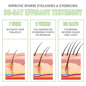 Tratamiento Nutritivo para Cejas y <span class=keywords><strong>Pestañas</strong></span>, Suero para Mejorar el Crecimiento, Queratina, Lifting de <span class=keywords><strong>Pestañas</strong></span>, Cuidado Posterior - Product Image 5