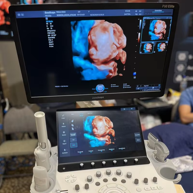 SonoScape P80 Elite Digital Color Doppler Ultrasound Machine 4D 5D OB GYN Cardiac Trolley Ultrasound Scanner for Vet