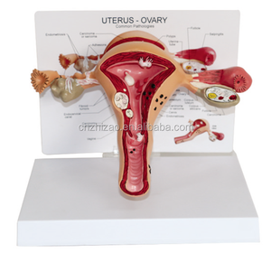 แบบจำลองการฝึกขยายขนาดมดลูกสำหรับวิทยาศาสตร์การแพทย์ สาขาวิชาพยาธิวิทยา แบบจำลองมดลูกสำหรับโรงเรียนแพทย์ - Product Image 1