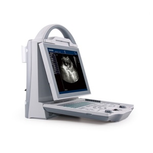Alat USG Hewan Klinik Hewan Kaixin KX5600V USG Hewan Portabel dengan Probe Rektal Linear - Product Image 2