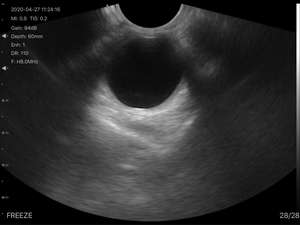 Alta Qualidade 192 Elementos Handheld Cor <span class=keywords><strong>Doppler</strong></span> Wifi & Usb Ultrassom <span class=keywords><strong>Transvaginal</strong></span> <span class=keywords><strong>Probe</strong></span> Konted C10QT - Product Image 5