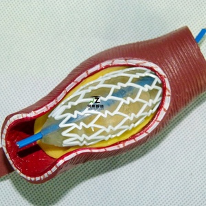 รูปแบบการสอนกระบวนการสาธิตการติดตั้งการใส่ท่อเลือดแบบขยายสำหรับหลอดเลือดของมนุษย์ - Product Image 2