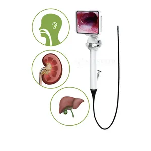 Endoskopi medis 2.8mm/3.8mm/4.8mm, endoskopi video serat optik fleksibel bronchoskop T bedah hidung