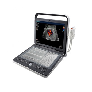 Escáner de Ultrasonido Portátil para Animales Sonoscape S9V de Alto Rendimiento para Diagnóstico en Granjas, Ganado y Clínicas Veterinarias - Product Image 5
