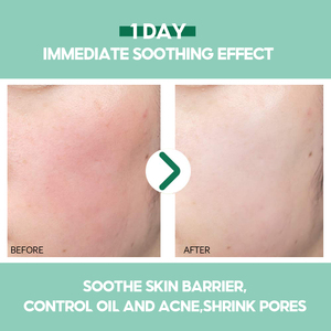 Productos de belleza para el cuidado de la piel, crema facial de Aloe Vera y loción hidratante, marca privada personalizada - Product Image 3