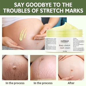 Crème Botanique Anti-Rides et Anti-Vergetures : Sûre pour les Mamans, Absorption Rapide, Lisse et Raffermit Visiblement la <span class=keywords><strong>Peau</strong></span> du Corps. - Product Image 4