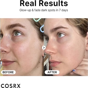 เซรั่มวิตามินซี 23 ขนาด 20 มล. ผลิตภัณฑ์บำรุงผิวหน้าจากเกาหลี ของแท้จากซัพพลายเออร์เกาหลี เครื่องสำอางเกาหลี - Product Image 3