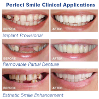 Faux Dentier Complet en Silicone Souple pour Haut et Bas – Prothèse Dentaire en Acrylique Malléable