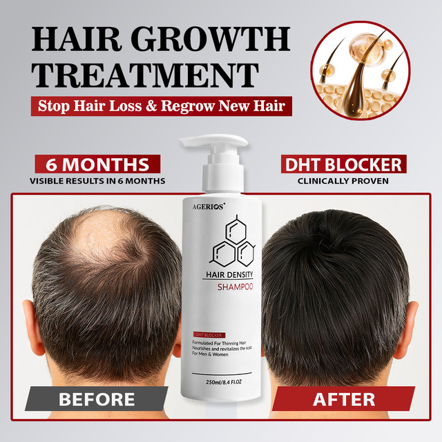 Clinical-Grade Hair Regrowth Shampoo Treatment with Advanced Growth Complex for Professional Scalp Vitality & Hair Density